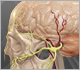 Nerve Conditions - Dr Jonathan Curtis MBBS, FRACS, Neurosurgeon